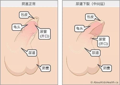 健康報 男性無法站著排尿？1.jpg